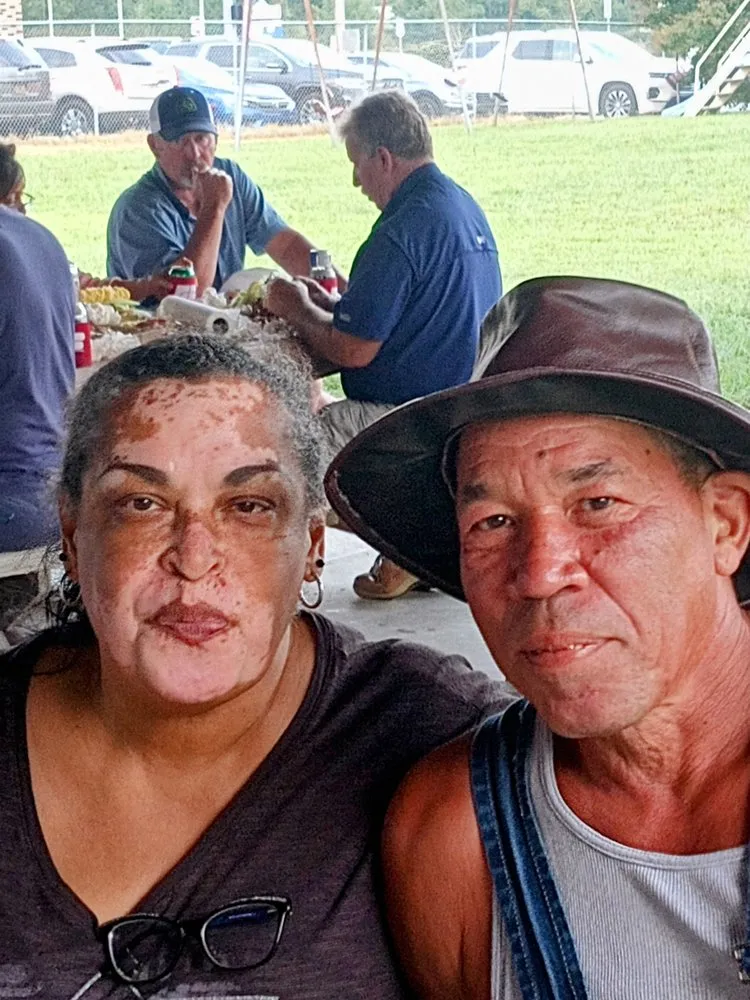 Expert yard cleanup service in Dover, DE - Cheap Lawn Service