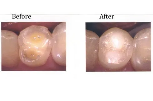 Trusted landscape installation for year-round maintenance in Chino, CA by Chino Lawncare