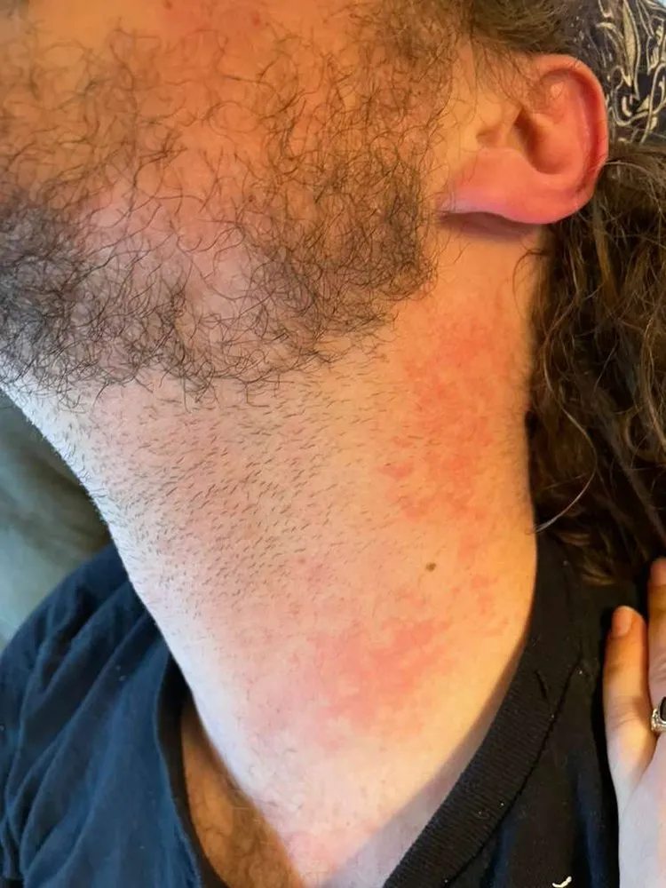 Local yard maintenance for residential properties across Bellingham, WA - Dependable Yard Care & Landscapes