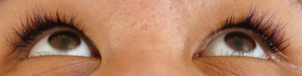 Reliable outdoor landscaping with custom design across Lynn, MA - Fresh Start Landscaping