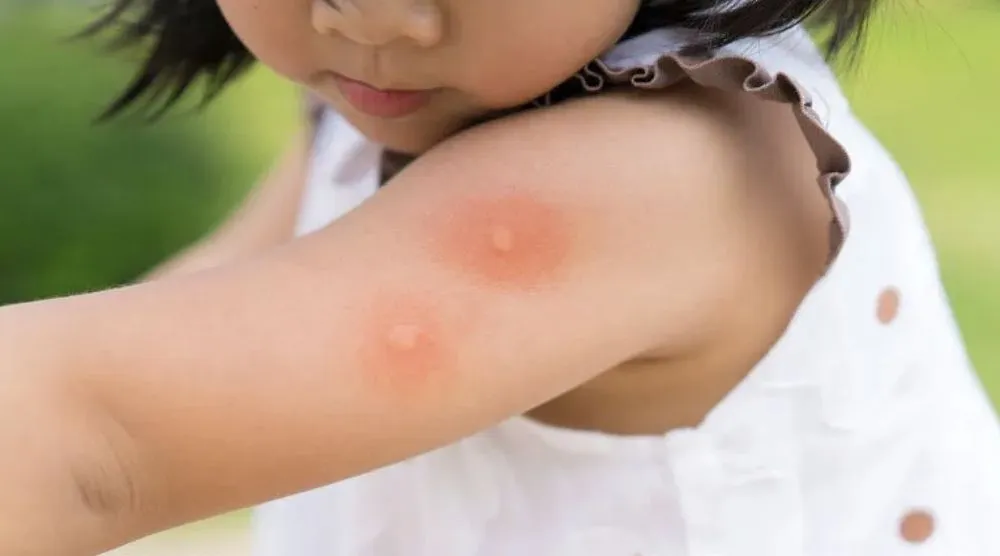 Top-rated landscape installation in Hollywood, FL - Gordon Services