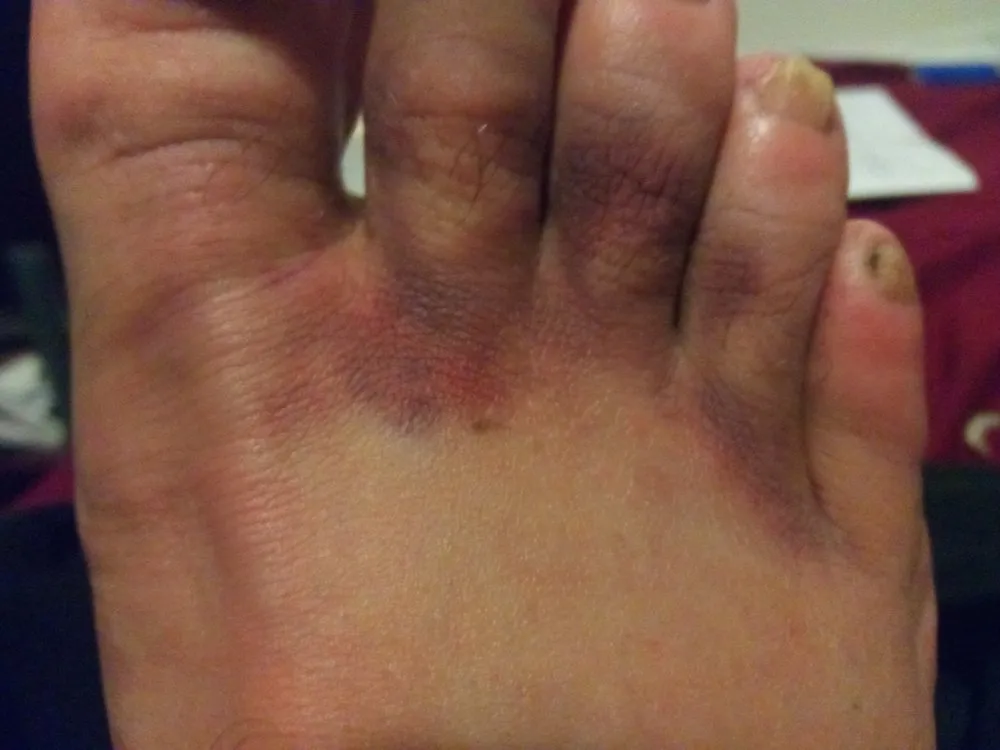 Top-rated residential landscaping for year-round maintenance in Piscataway, NJ by K.L.M. Tree Service & Landscaping