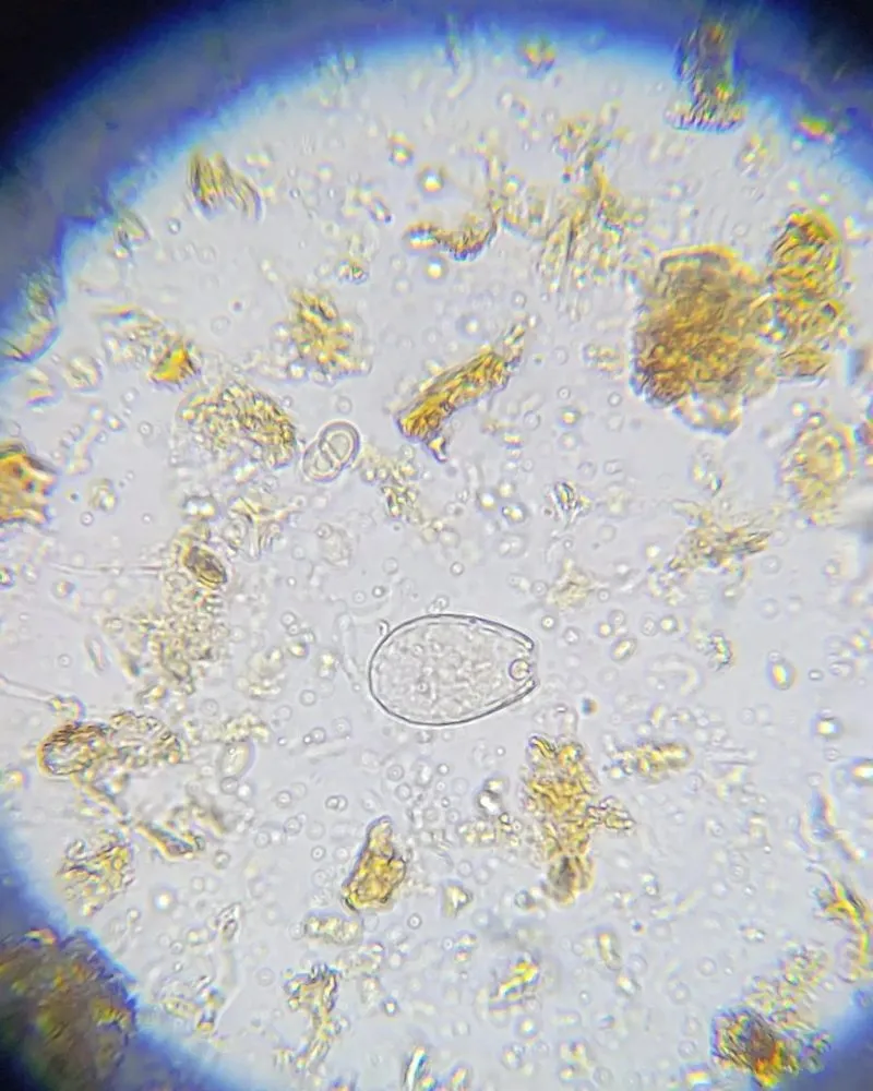 Trusted lawn care service near you in Houston, TX by Living With Soil Landscaping