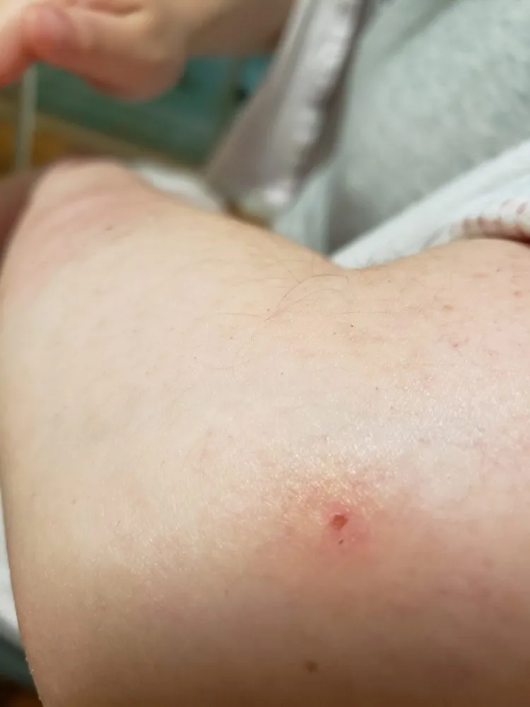 Local landscaping services with custom design in North Andover, MA by TruGreen